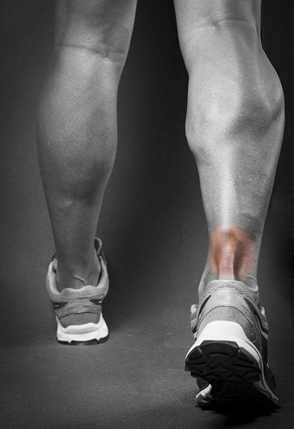 Achilles Pain