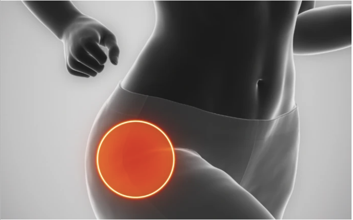 Are you suffering from pain in your hips or knees during or after your run?